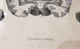 Старинная гравюра «Мозг и мозжечок», Германия, в. 19 в.