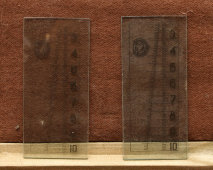 Комплект для эласто-тоннометрии по Маклакову, Одесский медицинский институт, 1960-е