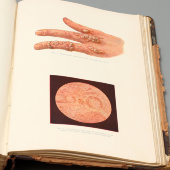 Учебник кожных и половых болезней с цветными иллюстрациями, С.-Петербург, 1910 г.