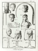Гравюра «Старинные приспособления в хирургии», Франция, 18 в.