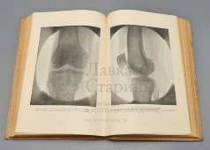 Старинная книга «Анатомический атлас для студентов и врачей», 11-е издание, автор Карл Тольдт, изд-во «Врач», Берлин, 1921 г.