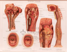 Старинная цветная медицинская гравюра в раме «Болезни горла», Россия, н. 20 в.