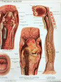 Старинная цветная медицинская гравюра в раме «Болезни горла», Россия, н. 20 в.
